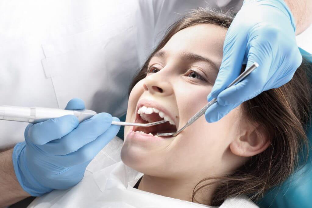 Dental Sealants - Kent Dentist