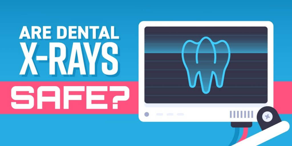 Are_Dental_X-Rays_Safe - Kent Dentist