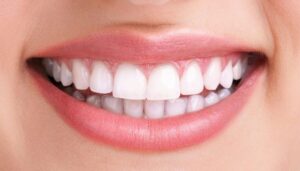 beautiful-smile - Kent Dentist