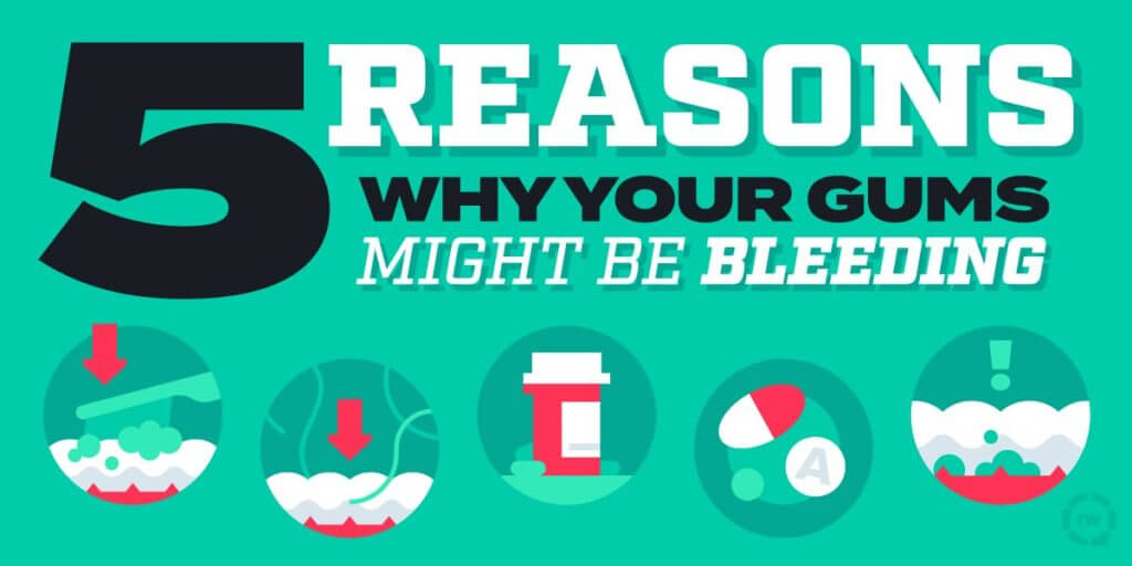 5_Reasons_Gums_Bleeding - Kent Dentist