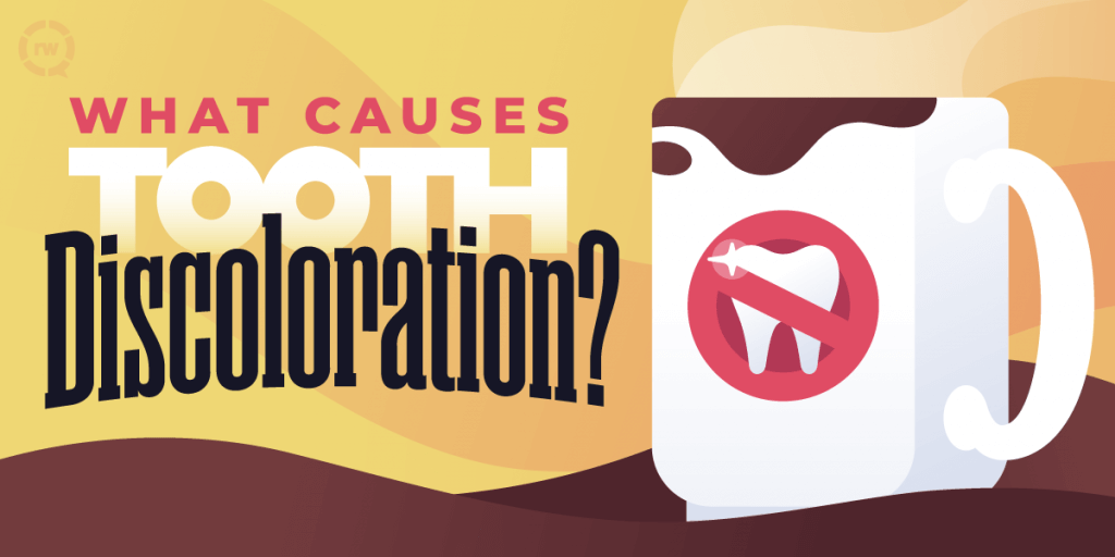 Teeth_Discoloration - Kent Dentist