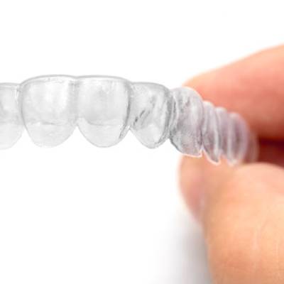 Custom Retainers - Kent Dentist