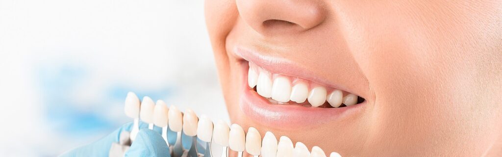 Dental Crowns - Kent Dentist
