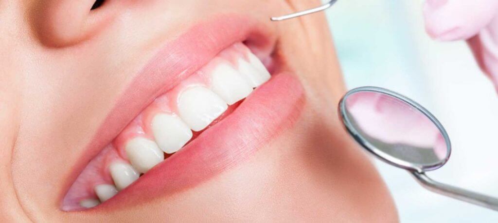 Dental-Health