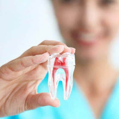 Endodontic (Root Canal) Treatment - Kent Dentist