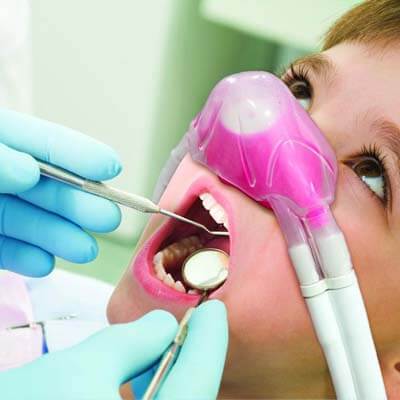 Nitrous Sedation - Kent Dentist