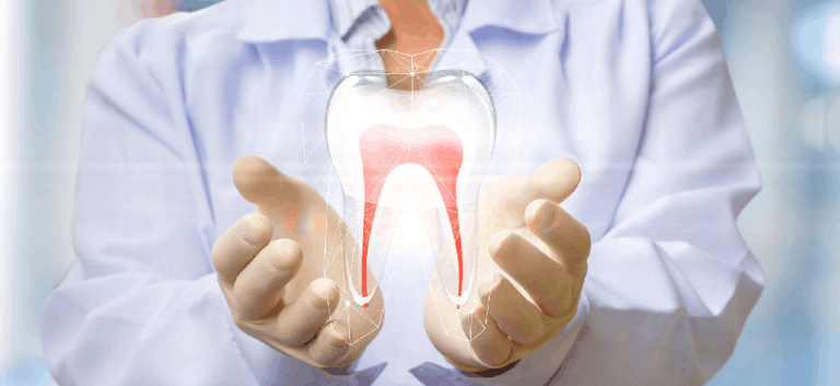 Root-canal - Kent Dentist