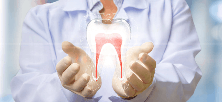 Endodontic (Root Canal) Treatment 1 Root-canal - Kent Dentist