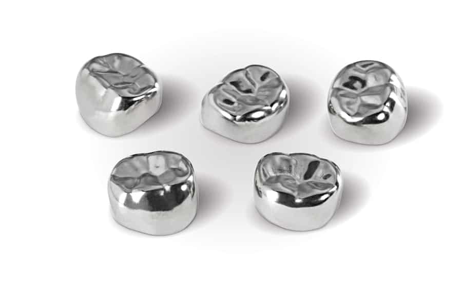 Stainless-steel Crowns 1 SS-Crowns - Kent Dentist
