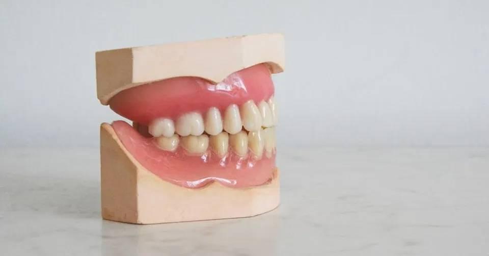 dentures - Kent Dentist