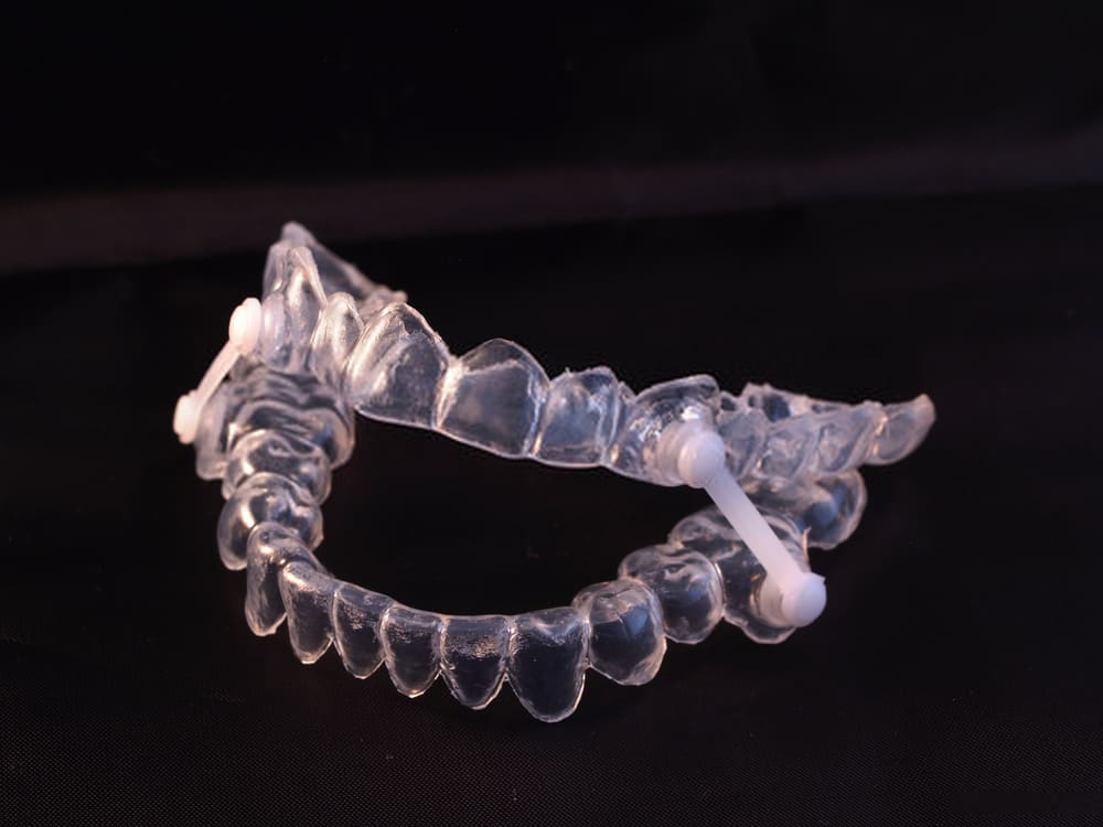 Occlusal Splint (Orthotic Device) 1 Orthotic Device - Kent Dentist