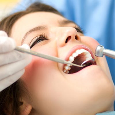 Preventative Dentistry service - Kent Dentist